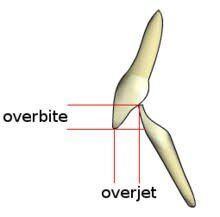 Oral Motor, Tooth Replacement, Periodontal Disease, Natural Teeth, Wisdom Teeth, Oral Health, Perth, In London, Medical