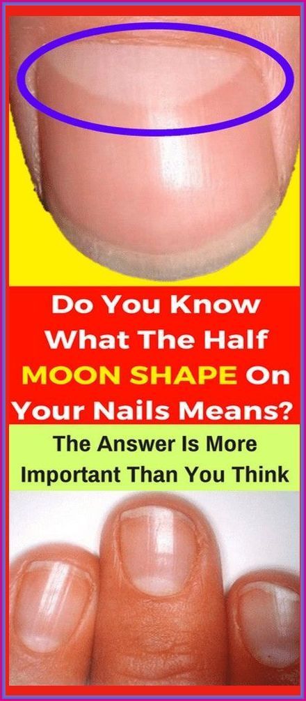 DO YOU KNOW WHAT THE HALF MOON SHAPE ON YOUR NAILS MEANS? ANSWER IS MORE IMPORTANT THAN YOU THINK! Nails Remedies, Layers Of The Epidermis, Tongue Health, Moon Nails, Chicken Skin, Moon Shape, Nail Health, Moon Shapes, Do You Know What