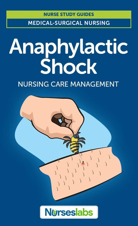 Anaphylactic Shock Nursing Care Management and Study Guide Medical Textbooks, Nursing School Prerequisites, Nursing Study Guide, Anaphylactic Shock, Nurse Training, Care Management, Nursing Care Plan, Surgical Nursing, Medical Surgical Nursing