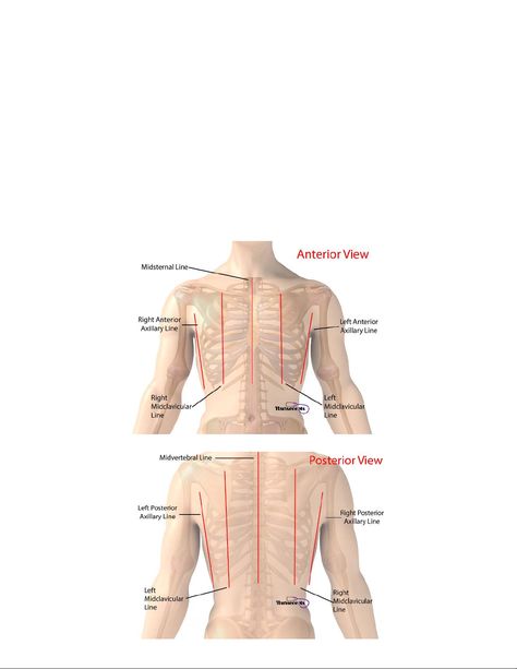 Lung Sounds Auscultation- Know where to place your stethoscope. - Auscultation of Normal Breath - StuDocu Lung Sounds, Breath Sounds, Medical Student Motivation, Nursing Study, Student Motivation, University Of Texas, Medical Students, Lungs, Pediatrics