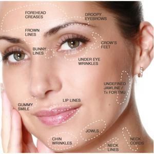 Botox Injection Sites, Chin Wrinkles, Botox Brow Lift, Forehead Acne, Botox Cosmetic, Facial Fillers, Facial Aesthetics, Botox Fillers, Under Eye Wrinkles