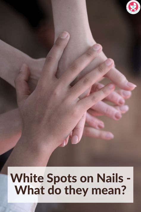 Have you noticed White Spots on Nails on your child's hands or feet? Find out what they could be and what you can do about them. White Spots On Fingernails, White Spots On Nails, Nail Care Diy, Baby Food Chart, Brittle Nails, Nail Plate, Simple Home, Dipped Nails, Greek Words