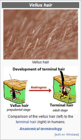 vellus hair and dermaplaning Waxing Studio, Best Permanent Hair Removal, Permanent Facial Hair Removal, Juice For Skin, Reduce Hair Growth, Nose Hair Removal, Vellus Hair, Lip Hair Removal, Upper Lip Hair