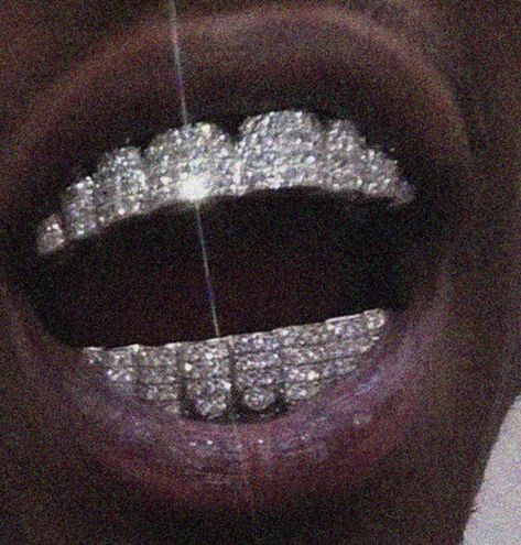 Diamond Grillz Men, Grills For Women Teeth Diamond, Grills Teeth Aesthetic, Grillz Teeth Men, Female Grillz Diamond, Diamond Teeth Aesthetic, Teeth Diamond Aesthetic, Diamond Fangs Grills, Grillz Girls Teeth