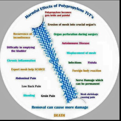 Bladder sling,bladder mesh, Polypropylene== DAMAGE Hidden Illness, Nerve Damage, Chronic Inflammation, Abdominal Pain, A Miracle, Autoimmune Disease, Nerve, Health Remedies, Chronic Pain