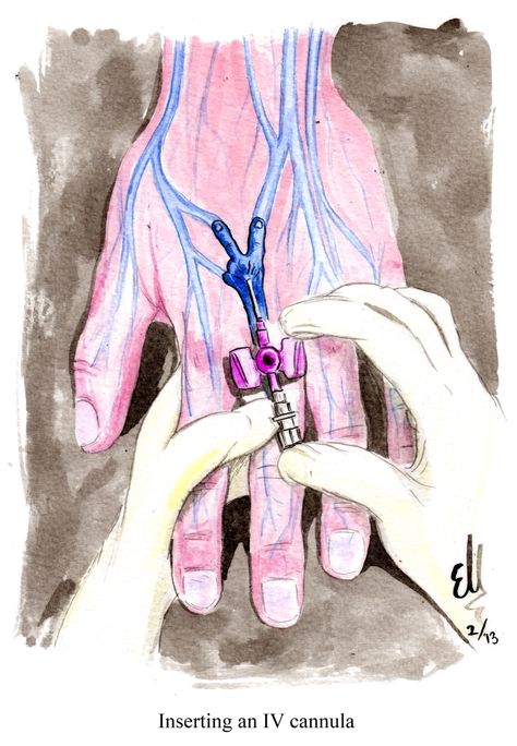 Inserting an IV cannula Iv Cannula, Gameboy Wallpaper, Nurse Skills, Medical Assistant Student, Nursing School Motivation, Medical School Life, Basic Anatomy And Physiology, Medical Student Motivation, Nurse Art