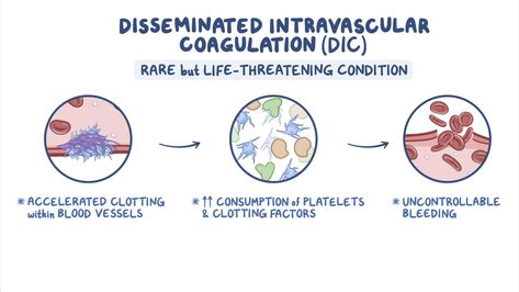 Dic Nursing, Disseminated Intravascular Coagulation, Nursing Videos, Video Library, Blood Vessels, Nursing, Conditioner