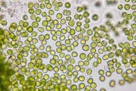 Chlorella under the microscope in Lab. Education of chlorella under the microsco , #Aff, #microscope, #Chlorella, #Lab, #chlorella, #Education #ad University Of Southampton, Under The Microscope, Human Genome, Green Algae, Pore Cleansing, Mockups Design, Skin Benefits, Photosynthesis, Animals Of The World