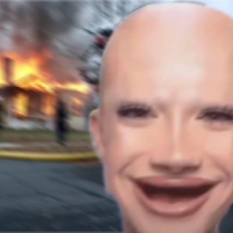 BALD JAMES CHARLES WITH NO TEETH SETTED MY HOUSE ON FIRE 🔥🔥🔥🔥 Bald James Charles With No Teeth, James Charles Funny Pictures, Cursed James Charles Images, Random Pictures To Airdrop People, James Charles Cursed Image, Cursed James Charles, Bald James Charles, James Charles Aesthetic, Funny James Charles