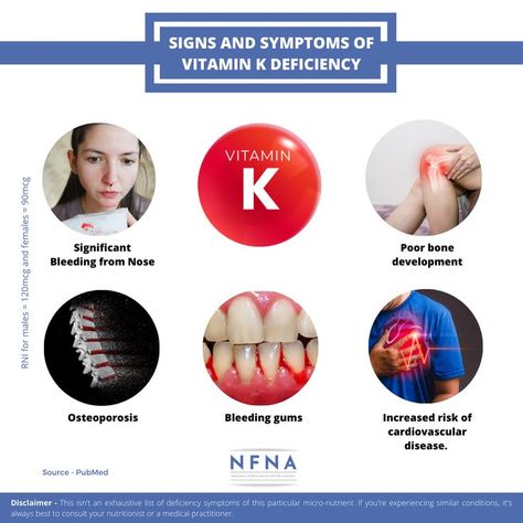 These are some of the symptoms of Vitamin K deficiency. People who are deficient in Vitamin K may experience some of these symptoms. ✅ In order to avoid these symptoms, it is necessary to fulfill your daily requirements of Vitamin K either from various food sources or from supplements.🥗💊 Vitamin K Deficiency, Nutrition Careers, Platelet Rich Plasma Therapy, Nutrition And Fitness, Fitness Career, Nose Bleeds, Course Schedule, Nutrition Course, Vitamin Deficiency