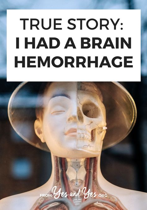 What's it like to have a brain hemorrhage? What are the warning signs? Click through for one woman's story of surviving a brain hemorrhage. Brain Bleed, Minimalism Living, Digital Signal Processing, Intentional Life, Shilpa Shetty, Signal Processing, The Warning, Warning Signs, Life Advice