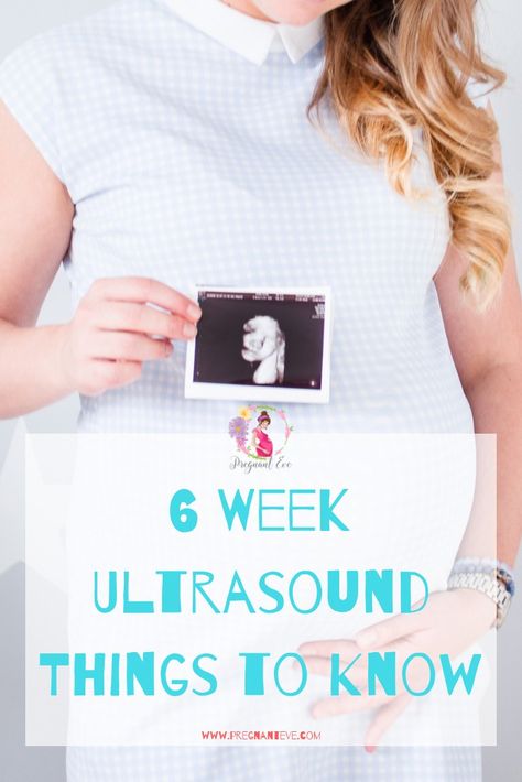 The first ultrasound takes place in the 6 week. You can hear your baby's heartbeat. Most of the times you don't see anything during the dating scan. What happens during 6 week ultrasound? Week 6 Of Pregnancy, 6 Week Ultrasound Pictures, 6 Weeks Pregnant Belly, 6 Weeks Pregnant Ultrasound, Ultrasound Pregnancy Announcement, 6 Weeks Pregnant, Baby Announcement To Parents, Pregnancy Facts, Pregnancy Ultrasound