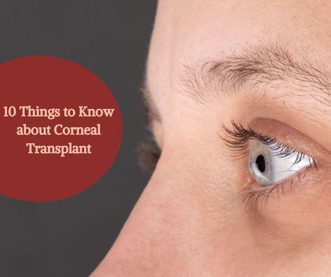 cornea surgery Cornea Eye, Corneal Transplant, The Surgeon, Focus Light, Things To Know, Surgery, Health, 10 Things