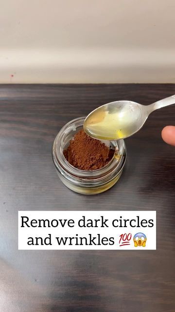 Coffee And Honey For Dark Circles, Instant Dark Circle Remedy, Dark Cercal Remove, Dark Circles Remove Tips, Dark Circles Remedies, Darkcircles Skincare, Dark Circle Remedies, Face Treatments, Natural Skin Care Ingredients