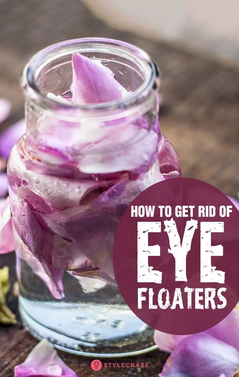 Natural Remedies For Eyesight, How To Get Rid Of Floaters In Your Eyes, How To Get Rid Of Eye Floaters, Irritated Eyes Remedies, Eye Floaters Remedies Natural Treatments, Castor Oil For Eye Floaters, Eye Floaters Remedies, How To Read Eyes, Floaters In The Eye