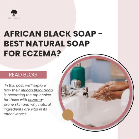 Finding the right skincare products can be challenging regarding eczema or atopic dermatitis. Many commercial soaps and body washes contain harsh ingredients like lauryl sulfate, which can strip the skin of its natural oils, making them bad news for eczema sufferers.   African Black Soap is a great choice for those with irritated eczema and sensitive skin made with all-natural ingredients, this incredible soap has been used in various African countries as a go-to remedy for various skin issues. African Skin Care, Skin Care Ingredients, African Black Soap, Body Washes, Black Soap, Daily Skin Care Routine, African Countries, Daily Skin Care, Skin Issues