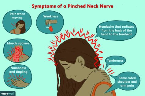 Pinched Nerve In Shoulder, Pinched Nerve In Neck, Trapped Nerve, Neck Headache, Occipital Neuralgia, Shoulder Stretches, Spinal Nerve, Pinched Nerve, Nerve Pain Relief