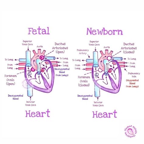 Obgyn Medical Assistant, Nurse Midwife Student, Sonography Student Notes, Diagnostic Medical Sonography Student Notes, Sonography Student Study Obgyn, Nicu Nurse Study Notes, Pediatric Cardiac Sonography, Nicu Nurse Notes, Midwifery Student Notes