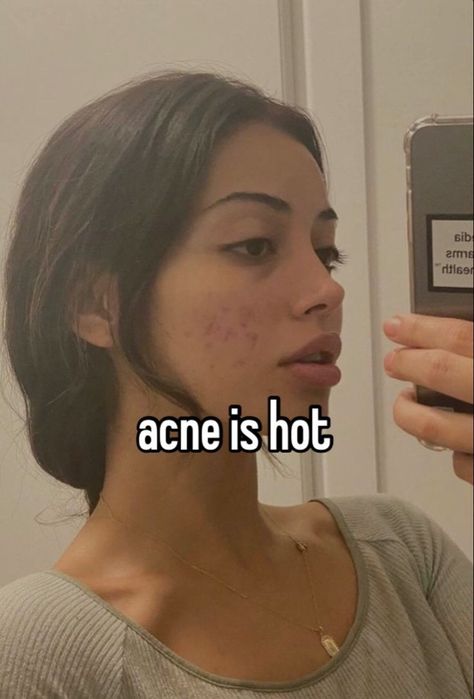 Korean Retinol, Academic Inspiration, Girl With Acne, Retinol Products, Universe Quotes, Pretty When You Cry, Hashtag Relatable, Pretty Skin, Funniest Memes