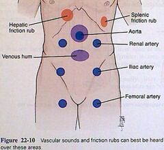 Abdominal assessment vascular sound points Nerdy Nurse, Health Assessment, Nclex Study, Nursing Exam, Nursing Pins, Pharmacology Nursing, Nursing School Survival, Trigger Point, Emergency Medicine