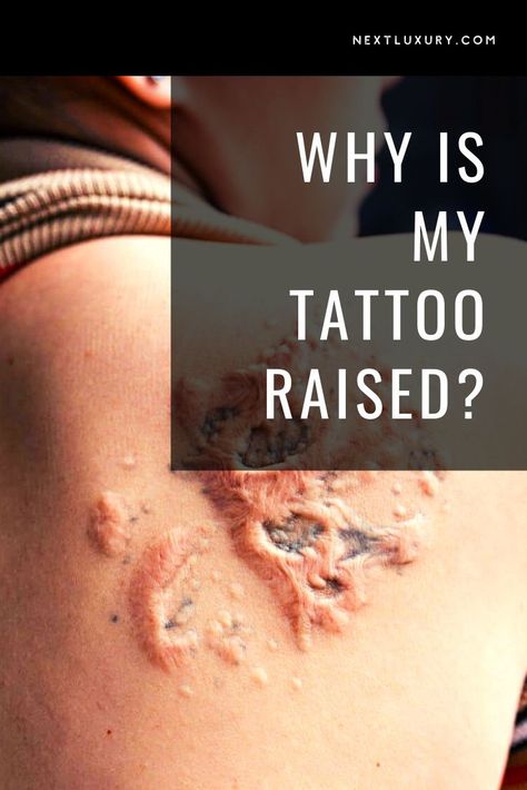 Healed Red Tattoo, Red Tattoo Healed, Layered Tattoo, Tattoo Healing Stages, Tattoo Healing Process, Infected Tattoo, Tattoo Healing, Healed Tattoo, Tattoo Process