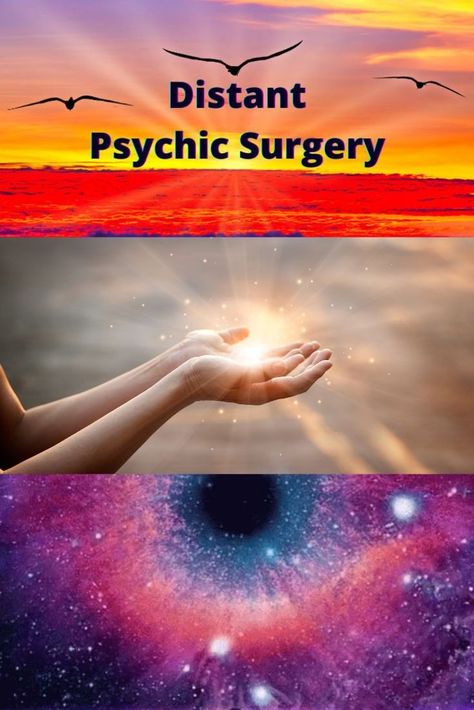 I will complete distant psychic surgery for anyone Psychic Surgery, Natal Charts, Spiritual Guidance, Psychic, Surgery, Astrology, Spirituality, Reading, Movie Posters