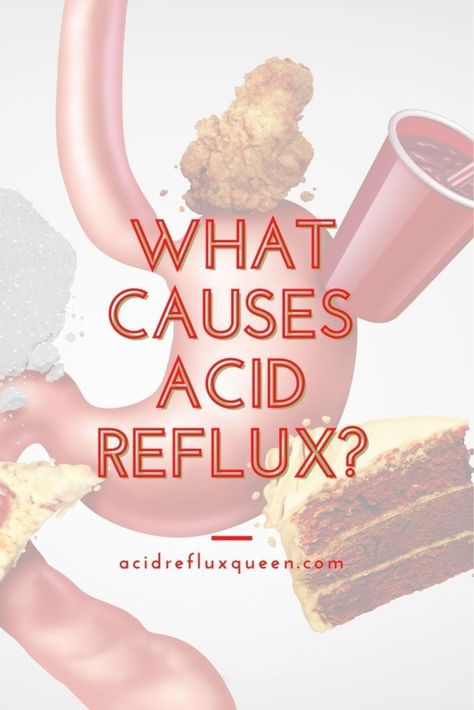 Dealing with chronic acid reflux for GERD and not sure why? Here's the common causes of acid reflux and how you can treat it naturally. Get rid of acid reflux. Natural remedies for acid reflux. GERD treatments. How to get rid of heartburn. Prevent heartburn and acid reflux. #acidreflux #heartburn #gerd Acid Reflux Foods, What Causes Acid Reflux, Acid Reflux Relief, Reflux Disease, Stomach Acid, Body Healing, Acid Reflux, Digestion Problems, Natural Treatments