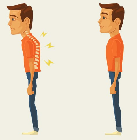 Fix Hunchback, Hunchback Posture, Dowager's Hump, Better Posture Exercises, Posture Correction Exercises, Neck And Shoulder Exercises, Forward Head Posture, Simple Exercise, Back Stretches For Pain