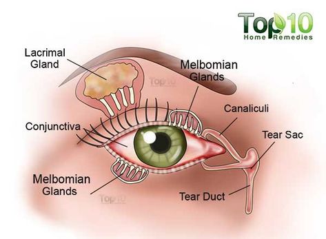 Dry Eye Remedies, Dry Eyes Causes, Dry Eye Symptoms, Top 10 Home Remedies, Dry Eye, Eye Exercises, Vision Eye, Eyes Problems, Hair Solutions