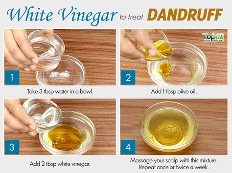 white vinegar for dandruff White Vinegar For Hair, Vinegar For Dandruff, Dandruff Solutions, Home Remedies For Dandruff, Hair Recipes, Dandruff Remedy, Scalp Problems, Top 10 Home Remedies, Getting Rid Of Dandruff