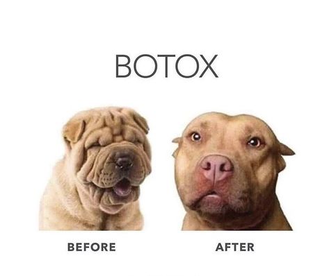 Saggy Cheeks, Botox Aesthetic, Botox Quotes, Botox Facial, Med Spa Marketing, Beauty Humor, Botox Before And After, Botox Lips, Laugh Together