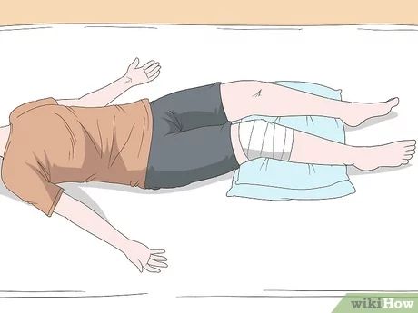 3 Ways to Sleep After a Knee Replacement - wikiHow Sleeping After Knee Replacement, Full Knee Replacement, After Knee Replacement Surgery, Knee Replacement Exercises, Knee Replacement Recovery, Partial Knee Replacement, Knee Surgery Recovery, Knee Operation, Knee Care