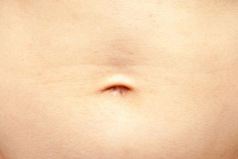 My Belly Button Smells - All Possible Reasons #bellybutton #health  #healthylifestyle Infected Belly Button, Belly Button Healing, Belly Button Smell, Odor Remedies, Swollen Belly, Skin Moles, Heat Rash, Smile Images, Extra Skin