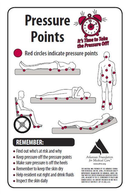 Pressure Ulcer Prevention, Geriatric Nursing, Wound Care Nursing, Medical Terminology Study, Wound Care Dressings, Nurse Teaching, Nursing Board, Nursing School Essential, Pressure Ulcer