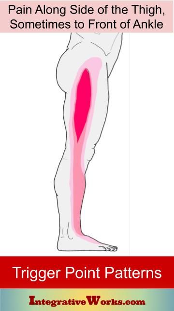 Pain Along Side of Thigh, Sometimes to Front of Ankle | Integrative Works Lower Leg Pain, Psoas Stretch, Calf Pain, Fascia Lata, Mid Back Pain, Arthritic Pain, Middle Back Pain, Walking Plan, Ankle Pain