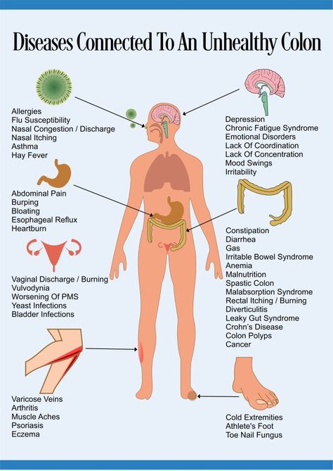 Intestinal Cleanse, Colon Health, Natural Colon Cleanse, Colon Cleanse, Body Detox, Muscle Aches, Abdominal Pain, The Human Body, Digestive System