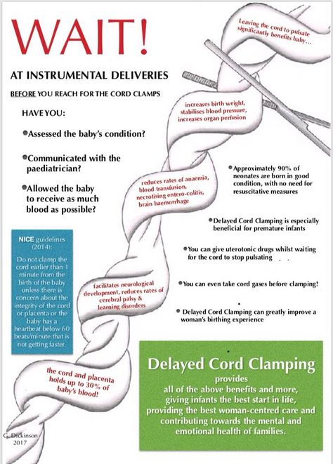 Optimum Cord Clamping: "Wait for White!" Delayed Cord Clamping, Midwifery Student, Doula Care, Student Midwife, Pregnancy Info, Children Health, Neonatal Nurse, Postpartum Doula, Childbirth Education