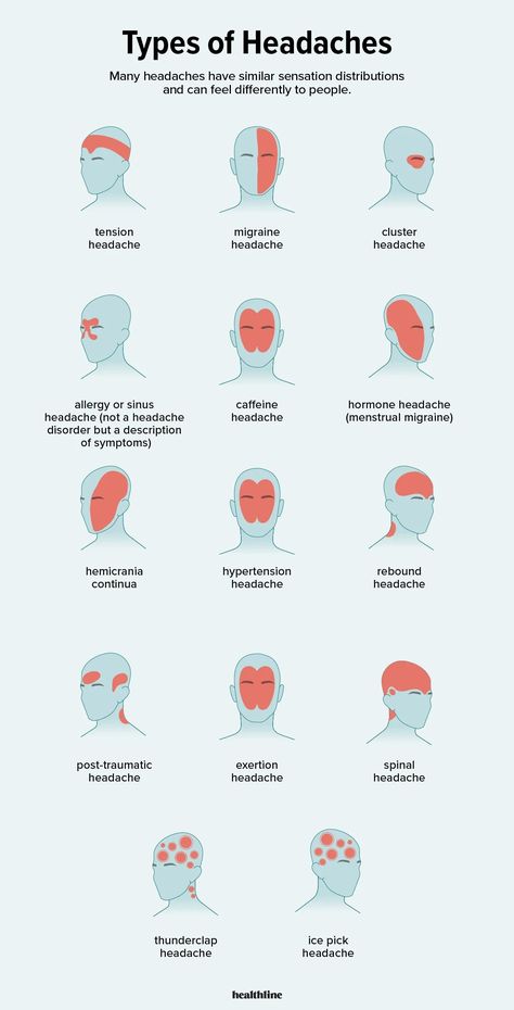 Types of Headaches: Symptoms, Causes, Treatments, and More Headache Types, Migraine Headaches, Medical Knowledge, Health Info, Health And Beauty Tips, Health Facts, Home Health, Useful Life Hacks, Migraine