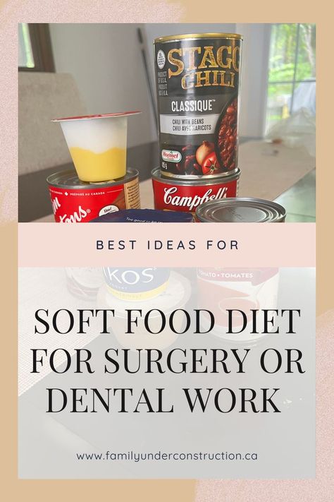 Soft Foods For After Dental Surgery, Soft Food Diet After Dental Implants, Delicious Soft Food Recipes, Soft Meats After Surgery, Soft Foods After Dental Implant Surgery, Soup After Dental Surgery, Soft Food After Surgery, Soft Food Ideas After Dental Work, Soft Foods After Surgery Teeth Dentures