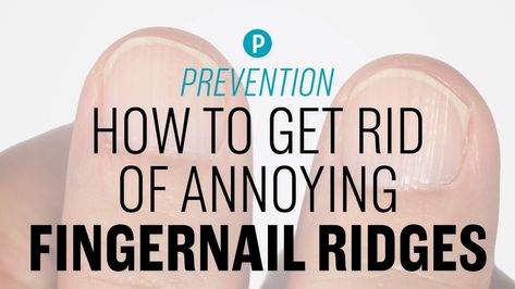 How to Get Rid of Annoying Fingernail Ridges Horizontal Nail Ridges, Vertical Nail Ridges, Fingernail Ridges, Pitted Nails, Karma Nails, Strong Healthy Nails, Nail Ridges, Moisturizing Hand Soap, Nail Buffers