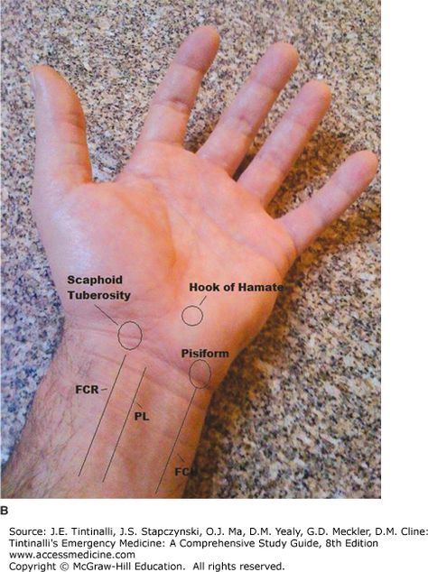 In Home Massage, Surface Anatomy, Pt School, Physical Therapy School, Hand Anatomy, Home Massage, Medical School Studying, Muscle Anatomy, Human Anatomy And Physiology