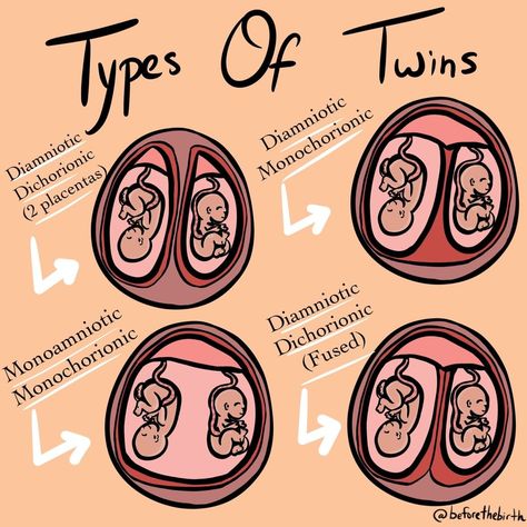 Types Of Twins, Midwifery Student, Diagnostic Medical Sonography, Student Midwife, Amniotic Fluid, Nursing School Motivation, Basic Anatomy And Physiology, Nurse Study Notes, Nursing Student Tips