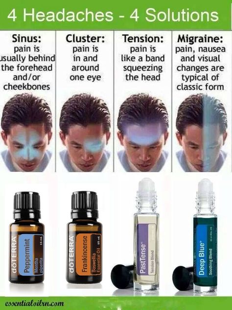 dōTERRA migraine and headache relief + diagram of migraine types Terra Essential Oils, Essential Oil Roller Bottle Recipes, Doterra Recipes, Essential Oils For Headaches, Doterra Essential Oils Recipes, Essential Oil Remedy, Doterra Oil, Essential Oils Guide, Do Terra