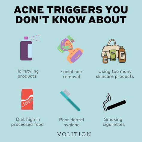 What Causes Acne, Treat Acne Naturally, Blind Pimple, Pimples Under The Skin, Bad Acne, Oily Skin Care Routine, Prevent Pimples, Skin Advice, Natural Acne Remedies