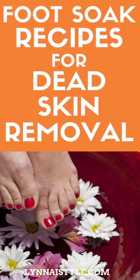 Callus Remover Diy, Home Foot Soak, Detox Foot Soak, Heal Cracked Heels, Homemade Foot Soaks, Foot Detox Soak, Listerine Foot Soak, Diy Foot Soak, Foot Soak Recipe