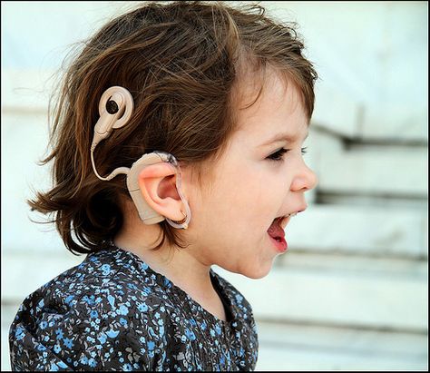 Cochlear Implants help people hear! Auditory Verbal Therapy, Hearing Problems, Cochlear Implant, Hearing Health, Best Speeches, Australian Men, Small Business Social Media, Speech Language Therapy, Hearing Loss