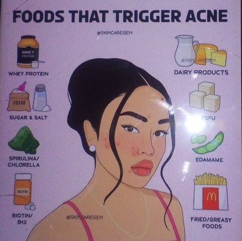 Acne Trigger Foods, Food Triggers For Acne, Foods That Can Cause Acne, Foods That Prevent Acne, How To Treat Inflammatory Acne, B12 Foods, Proactive Skin Care, Whey Protein, Acne