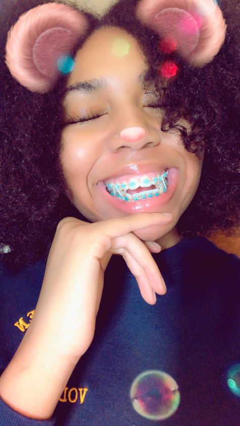 Teal Braces For Teeth, Aqua Braces, Lightforce Braces, Mint Green Braces, Desired Teeth, Teal Braces, Colored Braces, Brace Colors, Braces Girl