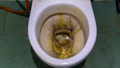 Toilet Bowl Stains, Borax Powder, Toilet Bowls, Acetic Acid, Grey Stain, Toilet Cleaning, Toilet Bowl, Mold And Mildew, Stain Remover