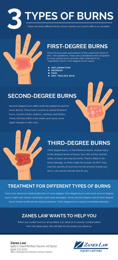 First Degree Burn, Third Degree Burn, Types Of Burns, Dry Peeling Skin, Constantine Hellblazer, Burn Injury, Degree Burns, Angina Pectoris, Severe Burns